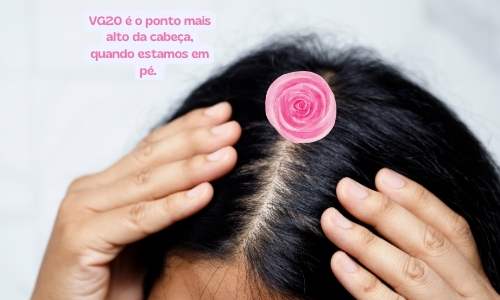 Região do Ponto VG20 marcada na cor Rosa - acupressão para aliviar a dor de cabeça.