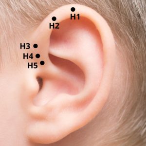 pontos-auriculoterapia-h1-h5-300x300 Hélix da Orelha Pontos de Auriculoterapia