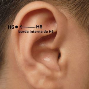Ponto Nervo Occipital Menor (H8) está localizado na borda interna no Tubérculo Auricular (H6).
